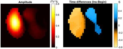 Case report: Post-thoracoscopy pendelluft monitoring